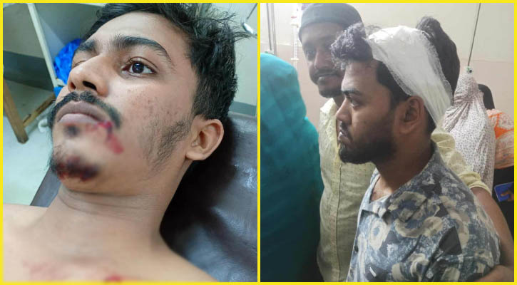 কনসার্টে ‘জয় বাংলা’ স্লোগান-উত্তেজনা, পুলিশের রাবার বুলেটে আহত ৩