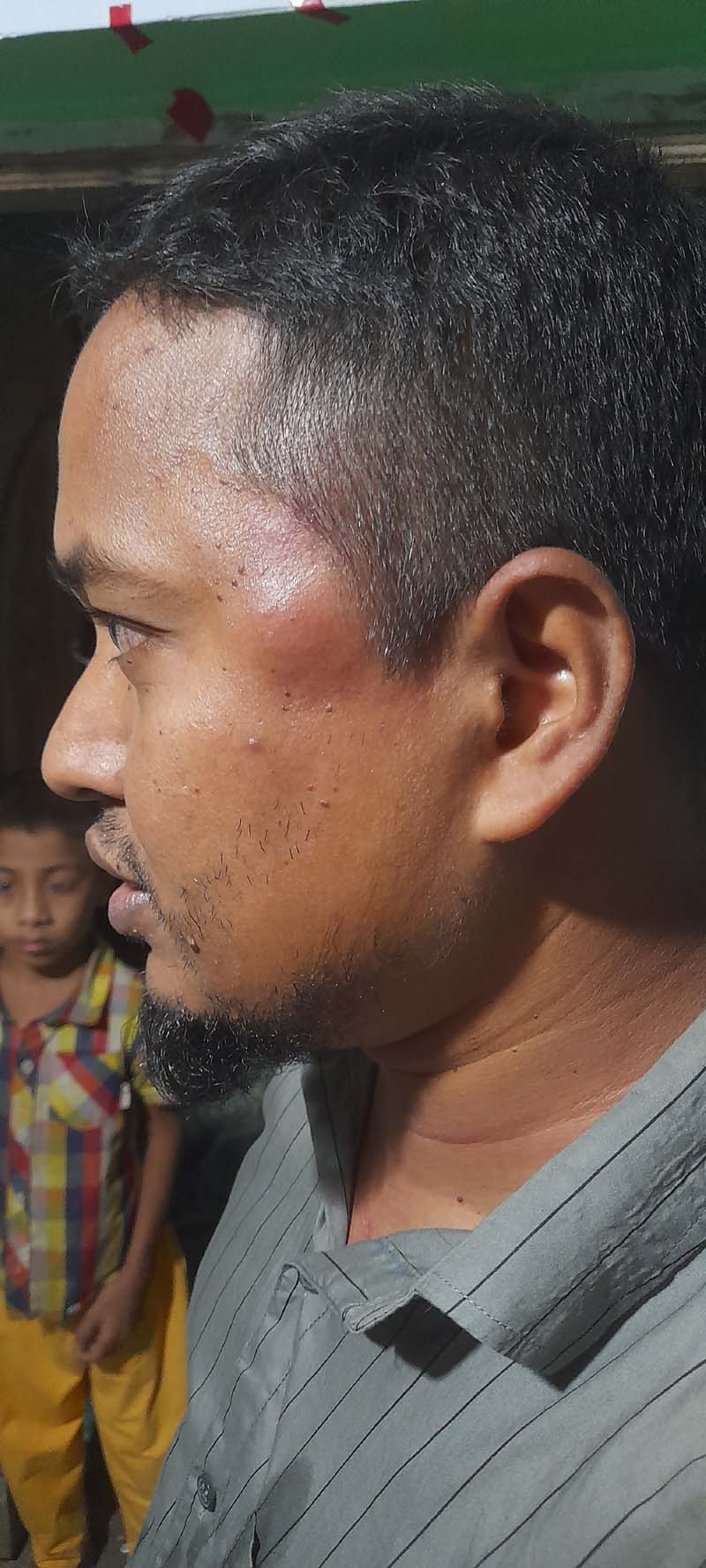 বোয়ালখালীতে সংবাদ প্রকাশের জেরে সাংবাদিককের উপর হামলা 