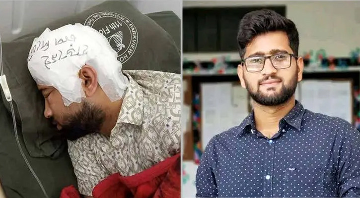 চবি শিক্ষার্থী মামুনের মাথার খুলি সফল প্রতিস্থাপন