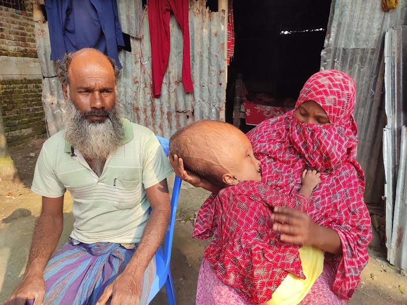 বিশাল আকৃতির মাথার যন্ত্রনায় চিৎকার করছে সরিষাবাড়ীর ৪ বছরের ছোট্ট শিশু মুসলিমা