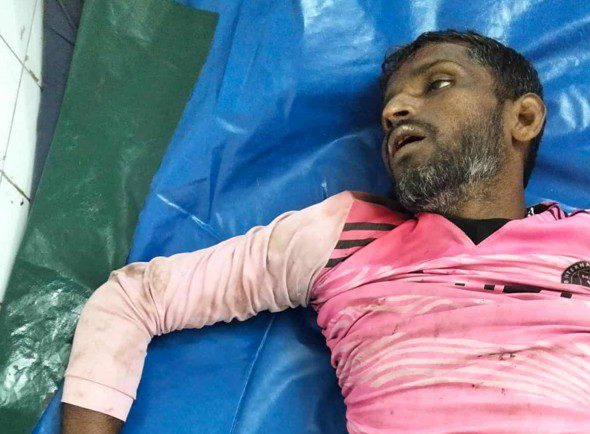 যশোরে গাছ থেকে পড়ে শ্রমিকের মৃত্যু