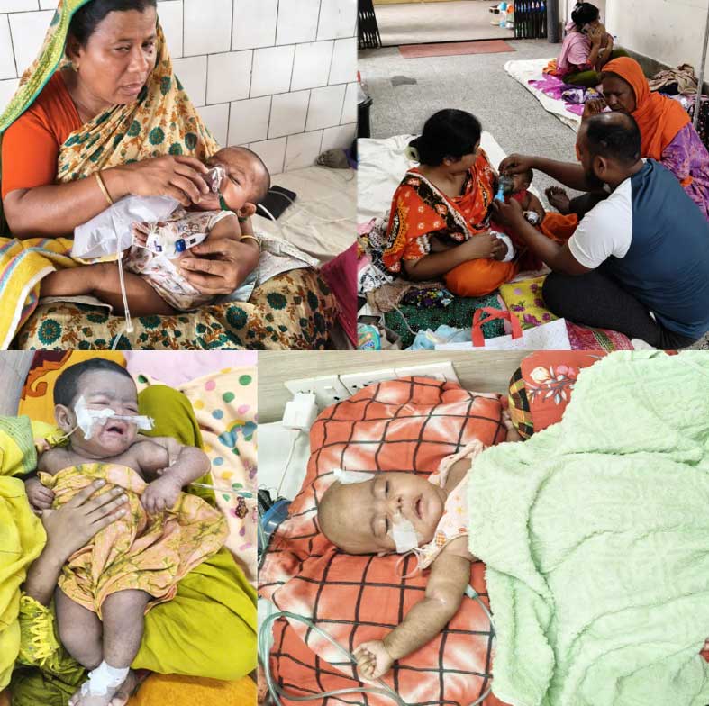 ভয়াবহ হামের প্রকোপ : ক্যানুলা ও নাকে নল নিয়ে হাসপাতালে লড়ছে হাজারও শিশু