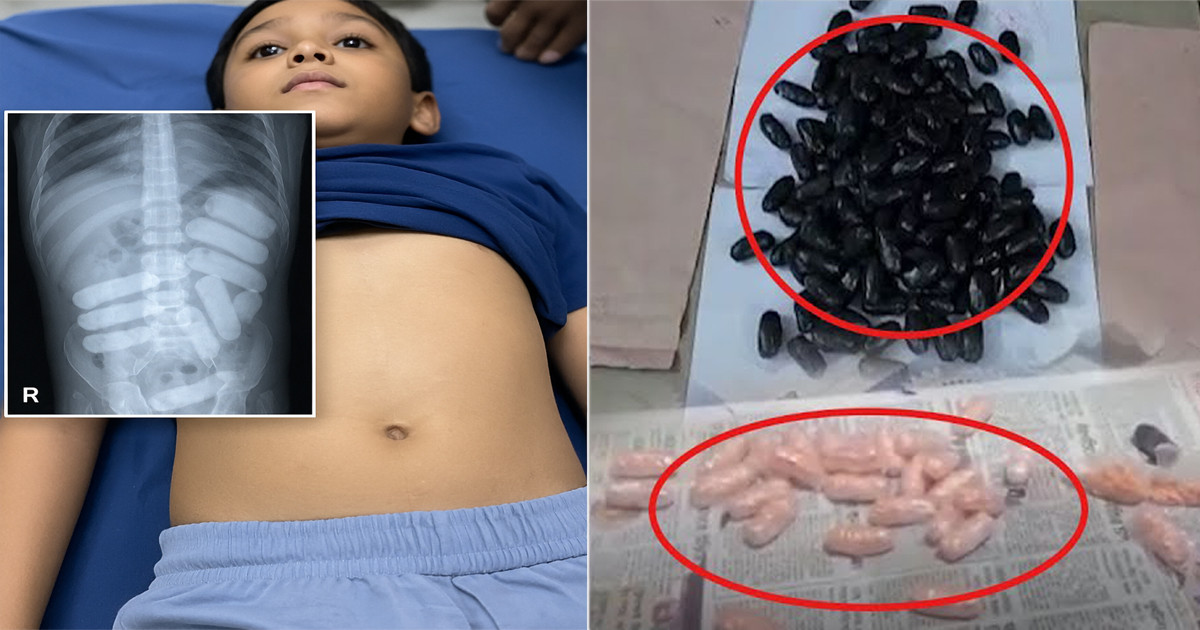 টাকার লোভে শিশুর পেটে ইয়াবা