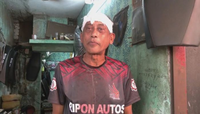 যশোরে ময়লা আর্বজনা ফেলা নিয়ে চলচ্চিত্র ও নাট্য অভিনেতা শমু চৌধুরী গুরুতর আহত